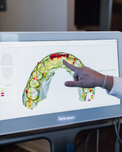 A technology called iTero Element which helps patients see how Invisalign improved their health